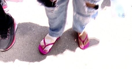 Queimadura de 2º grau não impede candidata de enfrentar dores e fazer Enem