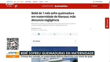 Bebê de 1 mês sobre queimadura em maternidade de Manaus