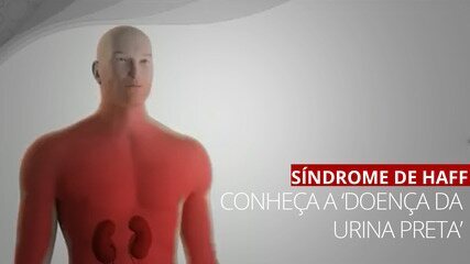 VÍDEO: conheça a doença da urina preta