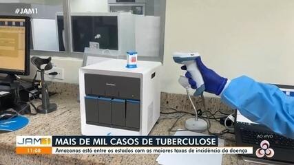 Mais de mil casos de tuberculose: Amazonas está entre estados com maiores taxas da doença