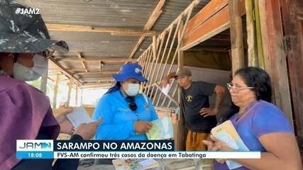 Três casos de sarampo são confirmados no Amazonas